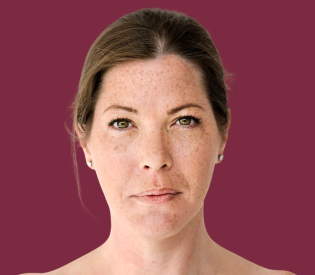 Pigmentation Treatment in Vasant Kunj, Delhi