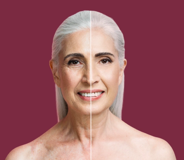 Wrinkle Reduction Treatment in Vasant Kunj, Delhi