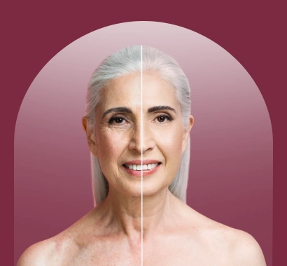 Wrinkle Reduction Treatment in Vasant Kunj, Delhi